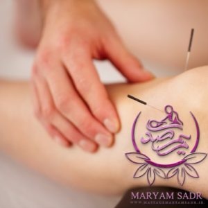 طب سوزنی (1)