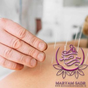 طب سوزنی (2)