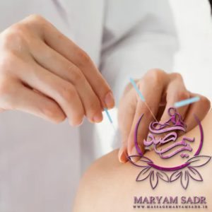 طب سوزنی (3)